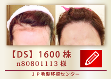 【DS】1600株