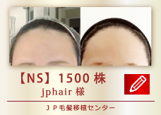 【NS】1500株