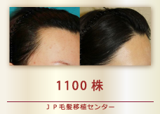 1100株