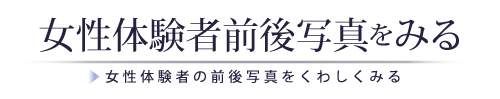 女性体験者前後写真をみる