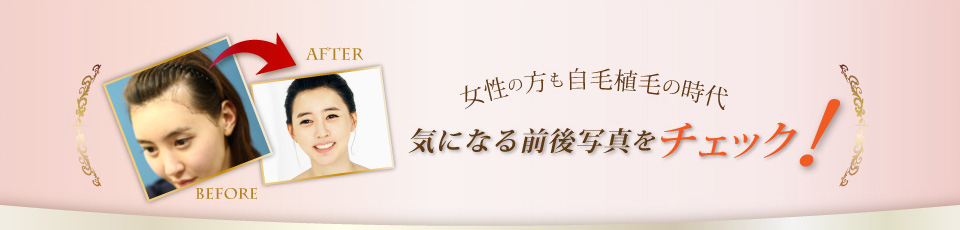 気になる前後写真をチェック!