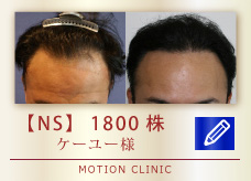 【NS】　1800株