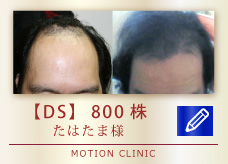 【DS】　800株