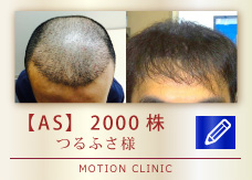 【AS】　2000株