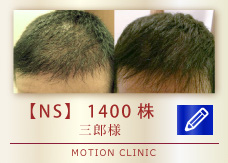 【NS】　1400株