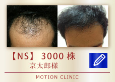 【NS】　3000株