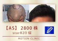 【AS】　2800株
