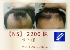 【NS】　2200株