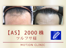 【AS】　2000株