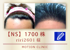 【NS】　1700株