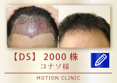 【DS】　2000株