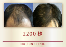 2200株