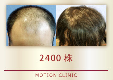 2400株