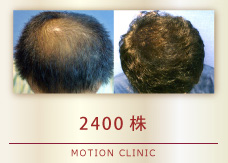 2400株