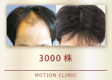 3000株