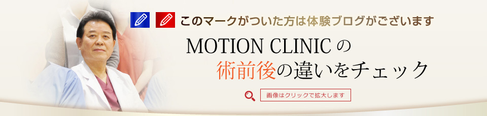MOTION CLINIC の術前後の違いをチェック