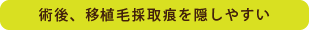 術後、移植毛採取痕を隠しやすい
