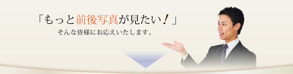 「もっと前後写真が見たい！」そんな皆様にお応えいたします。