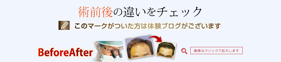 術前後の違いをチェック