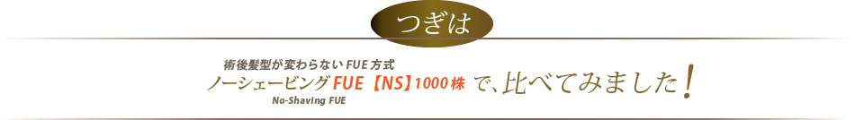 術後髪型が変わらないFUE方式
